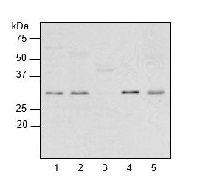 RPL2 | Ribosomal protein L2 (chloroplastic) in the group Antibodies Plant/Algal  / DNA/RNA/Cell Cycle / Translation at Agrisera AB (Antibodies for research) (AS15 2876)
